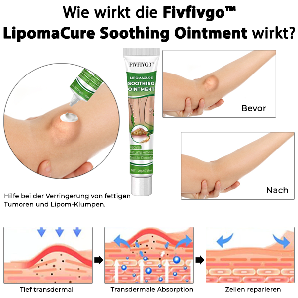 Fivfivgo™ LipomaCure Soothing Ointment