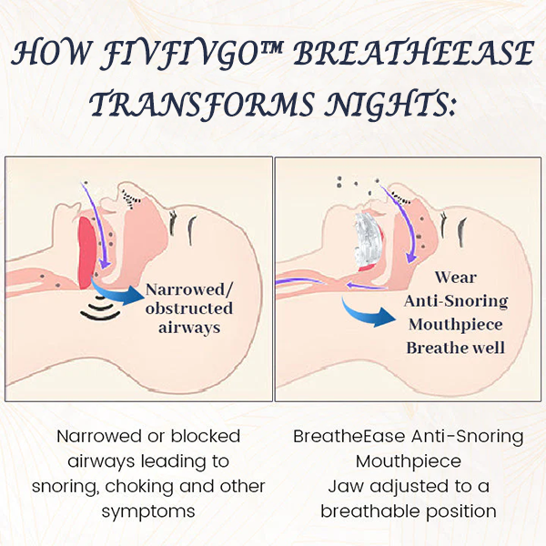Fivfivgo™ BreatheEase Anti-Schnarch-Mundstück