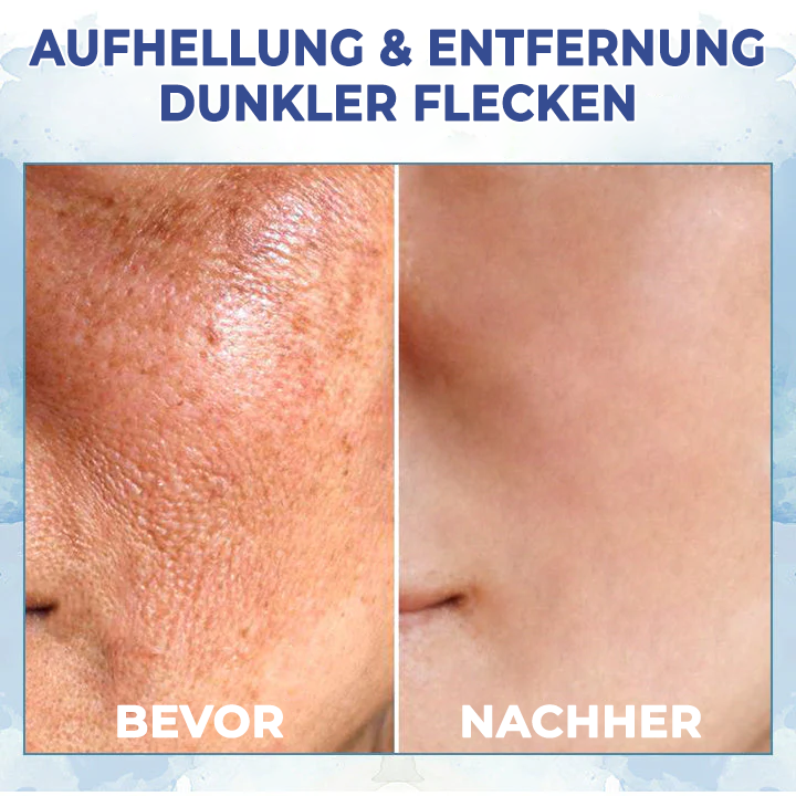 Fivfivgo™ LuxeLift Hautstraffende Jugendbutter