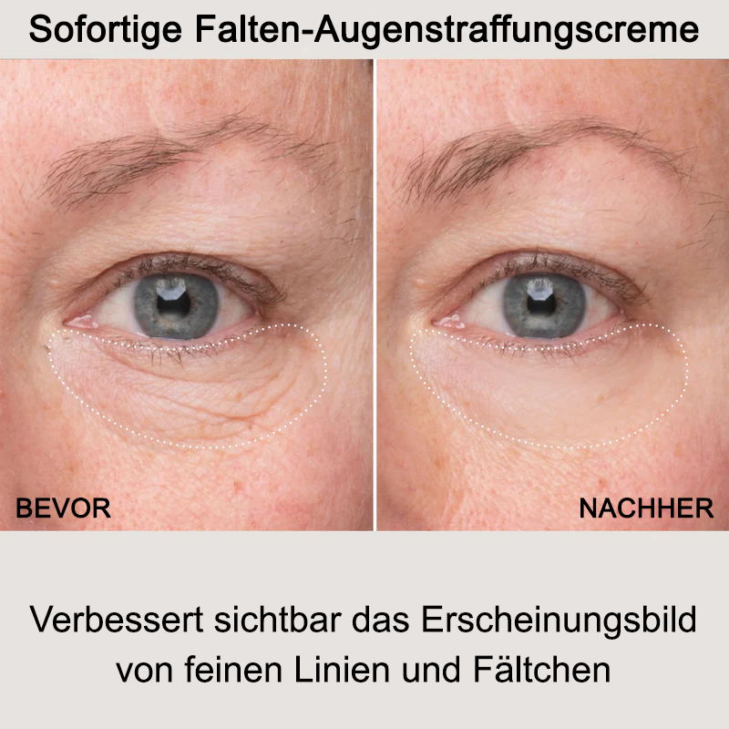 Fivfivgo™ Creme zur sofortigen Straffung der Augenfalten