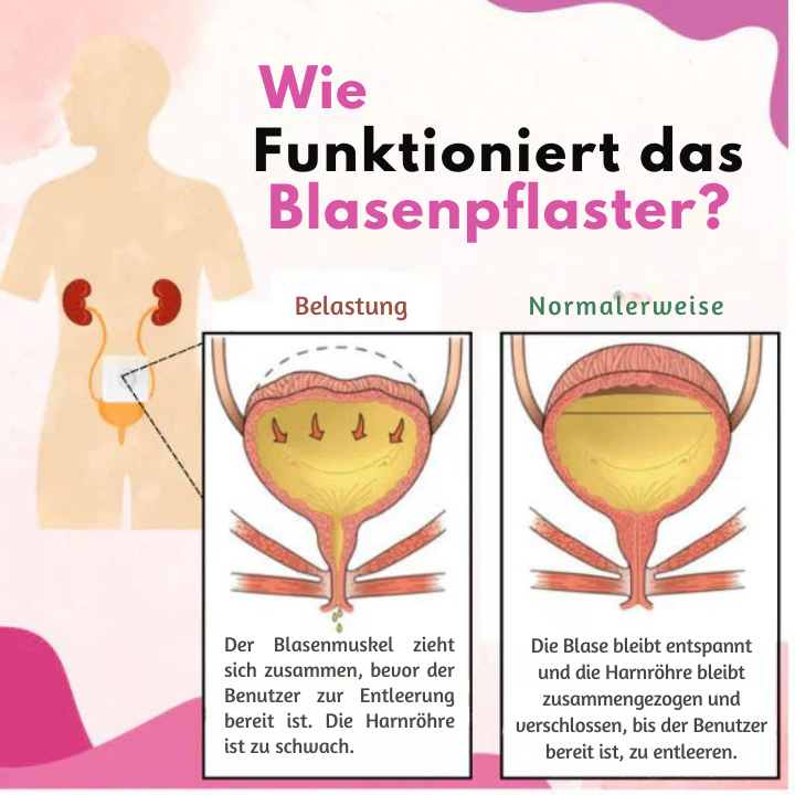 Fivfivgo™ Blasenkontrolle Anti-Inkontinenz-Pflaster