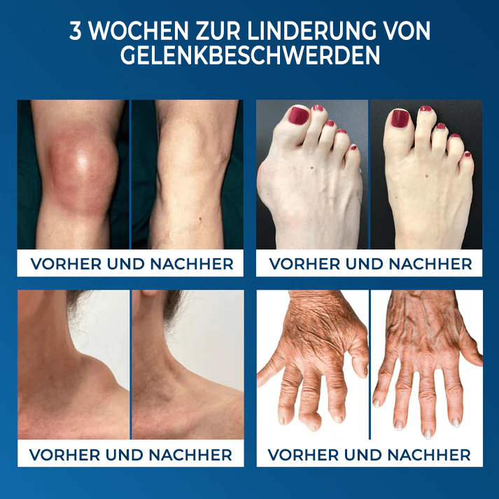 Fivfivgo® Flexfixer Gelenkentlastungs-Serumampulle