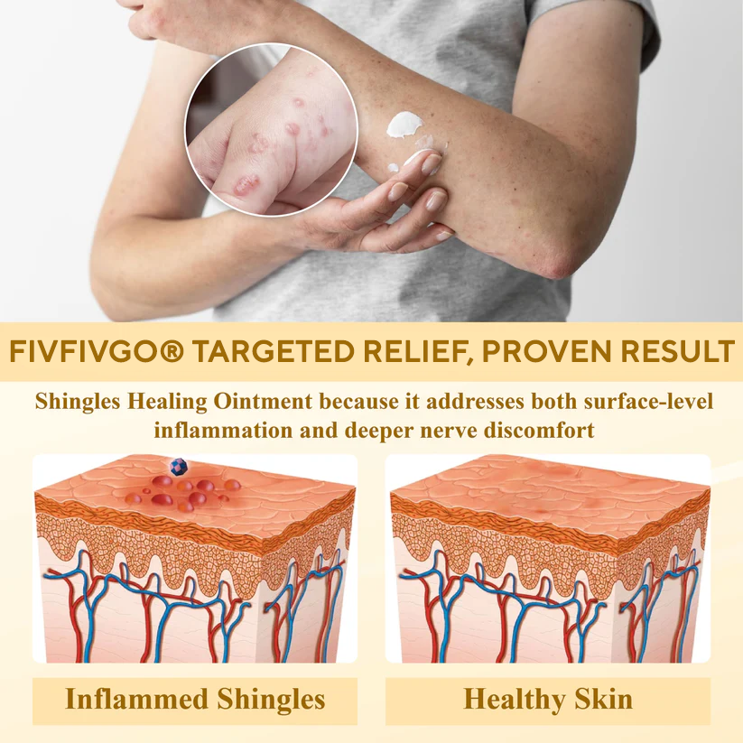 Fivfivgo® NervoRelief Shingles Healing Ointment