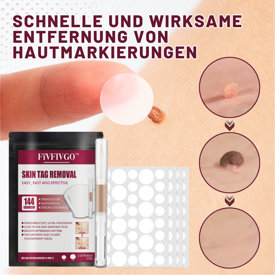 Fivfivgo™ Haut Tag Entfernungsaufkleber