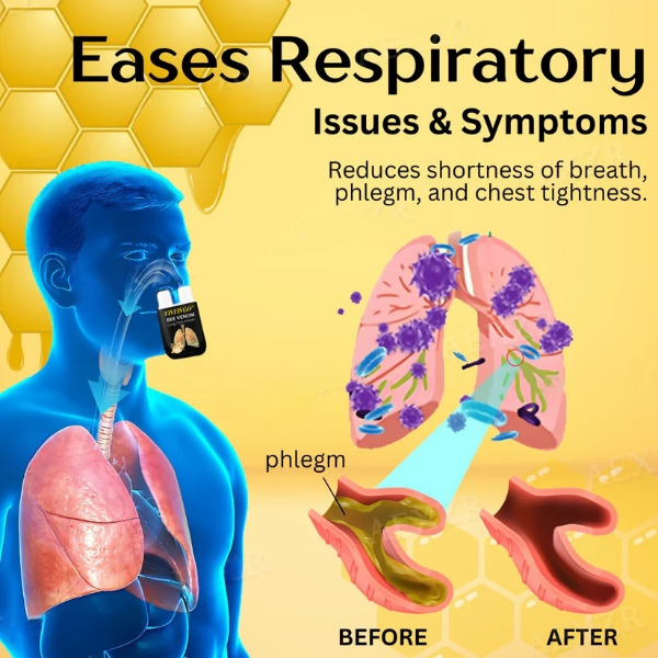 Fivfivgo™ Bee Venom Lung Care Inhaler