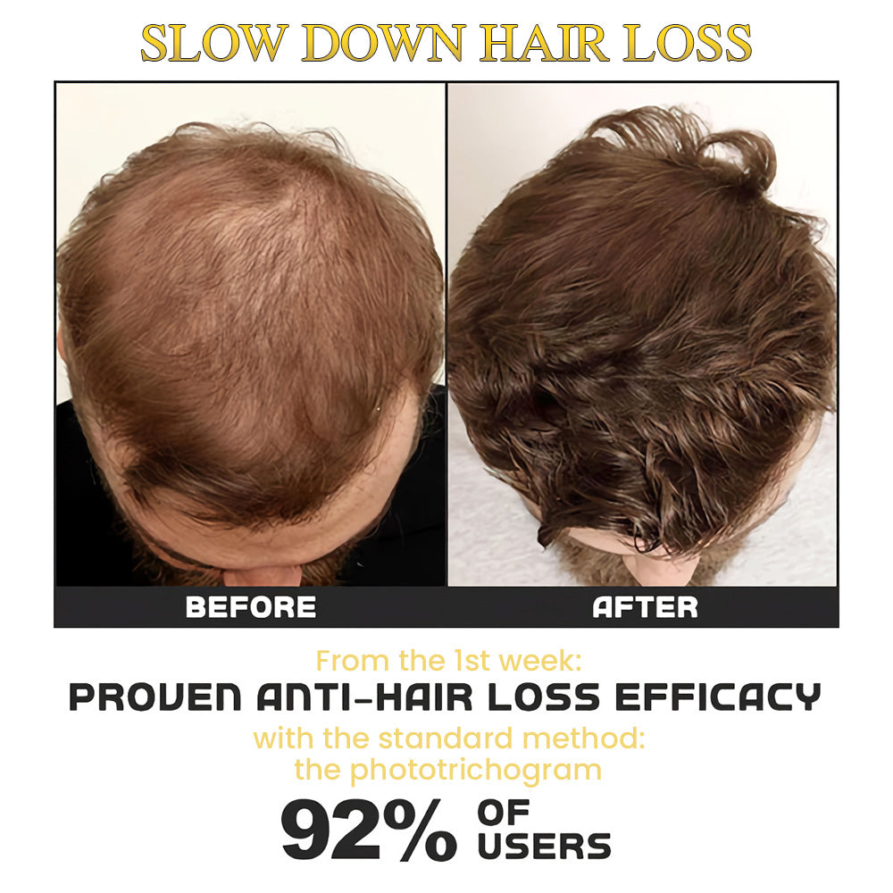 Fivfivgo™ Traitement capillaire Biotin REGrowth Roll-On