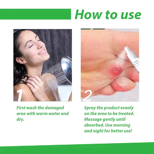Fivfivgo™ Power Spray per la rimozione del mais