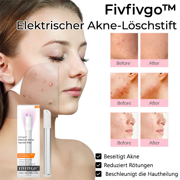 Fivfivgo™ Elektrischer Akne-Löschstift