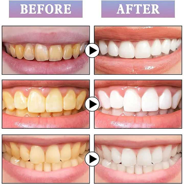 Fivfivgo™ NiceSmile Teeth Whitening Essence