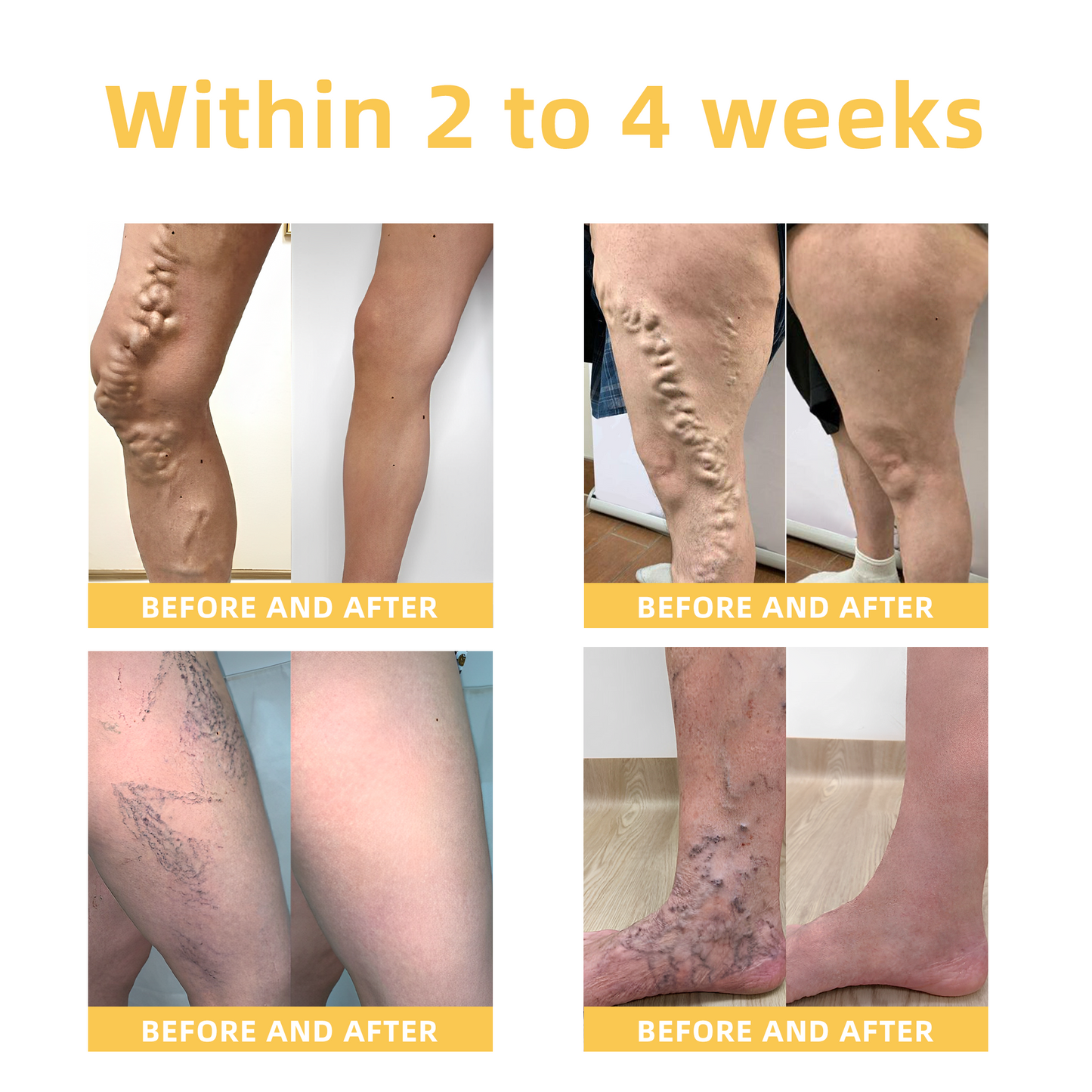 Fivfivgo™ Arthritis und Varikose Behandlung Creme