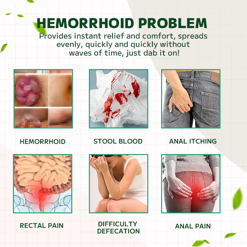 Fivfivgo™ Hemorrhoidal Ointment
