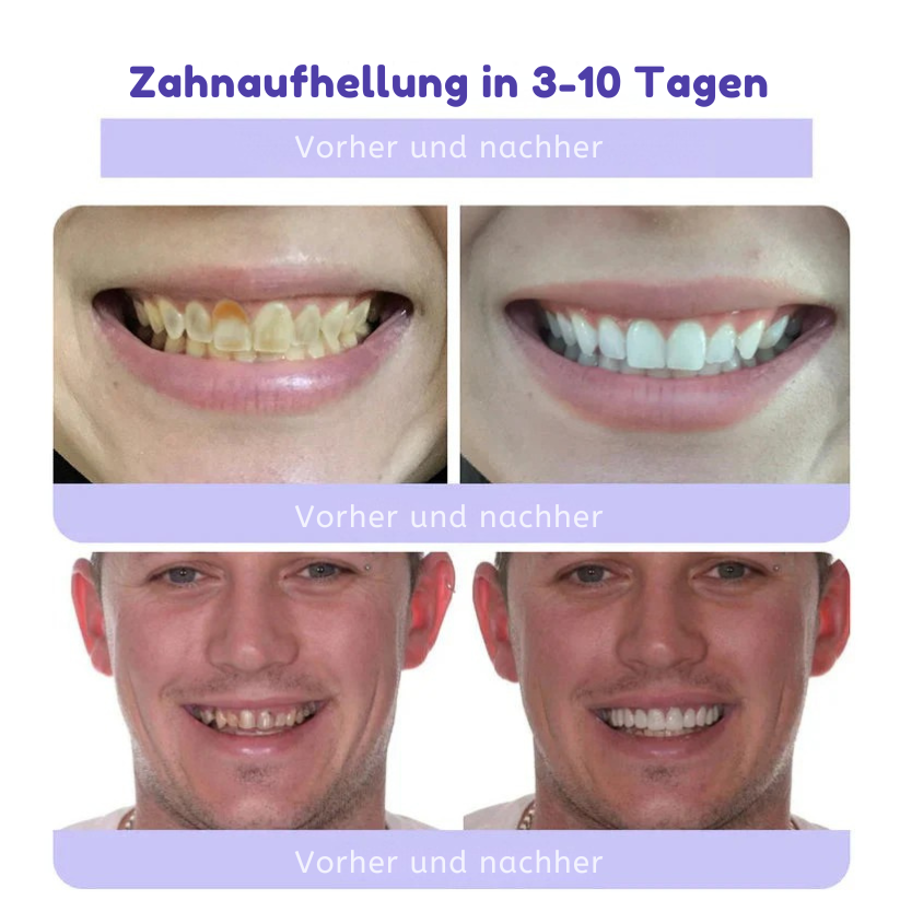 Fivfivgo™ Zahnrestauration Mineralisches Puder