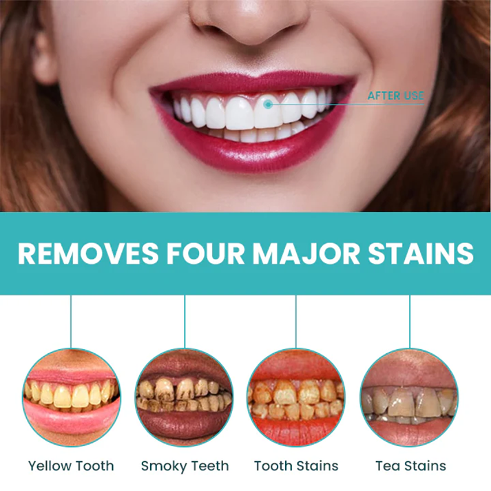 Fivfivgo® Instant Teeth Whitening Paint