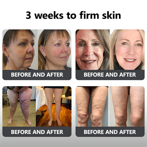 Fivfivgo™ Flüssiges Peptid-Peeling-Essenz