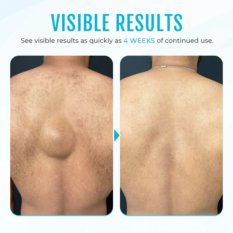Fivfivgo™ LumpClear Lipom Entlastungscreme