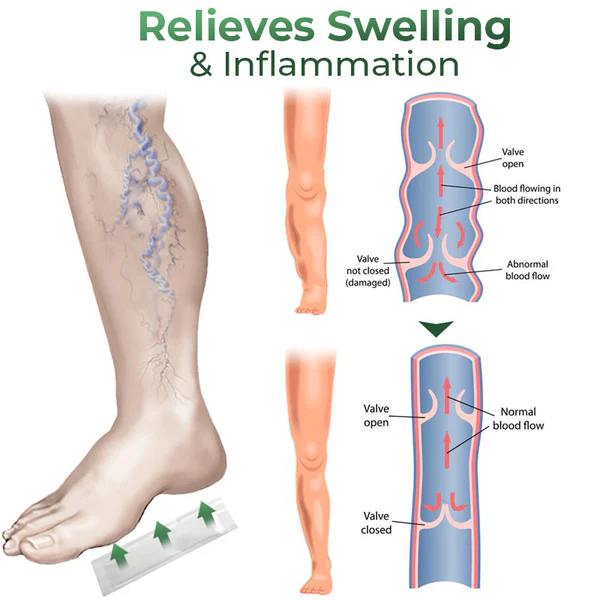 Cvreoz® Varicose Vein Relief Herbal Foot Patch