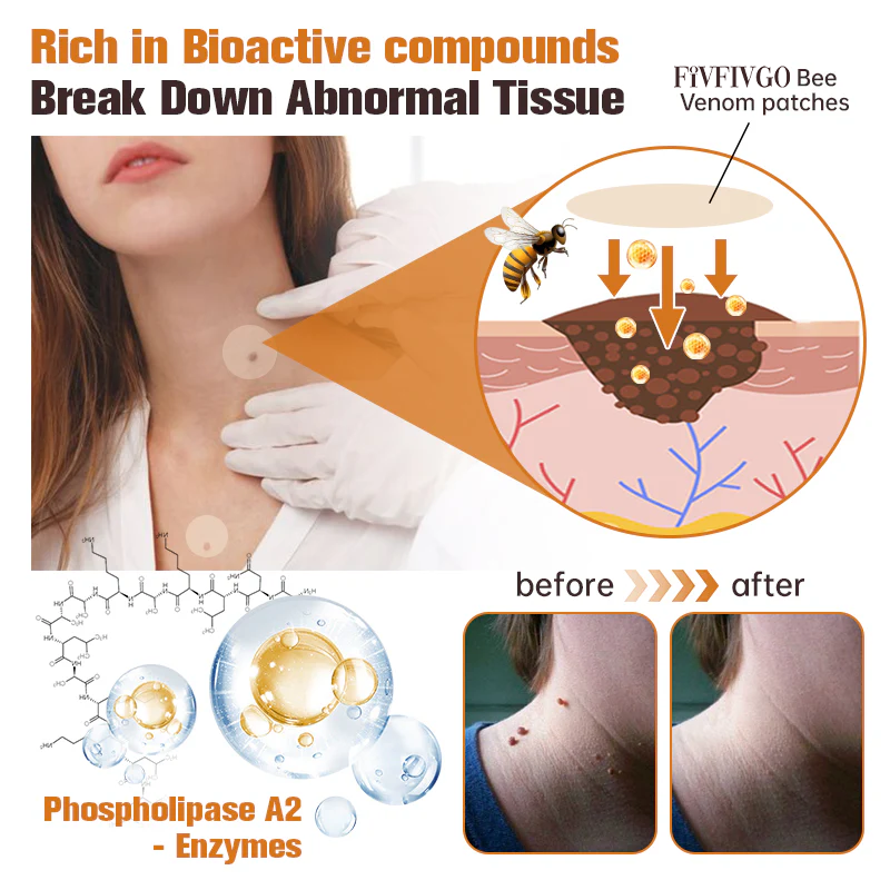Fivfivgo™ WartGone Bienengift-Behandlung Patch