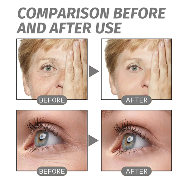 Fivfivgo™ tief feuchtigkeitsspendende Oxygen Facial Liquid Lift Advanced Wrinkle Treatment