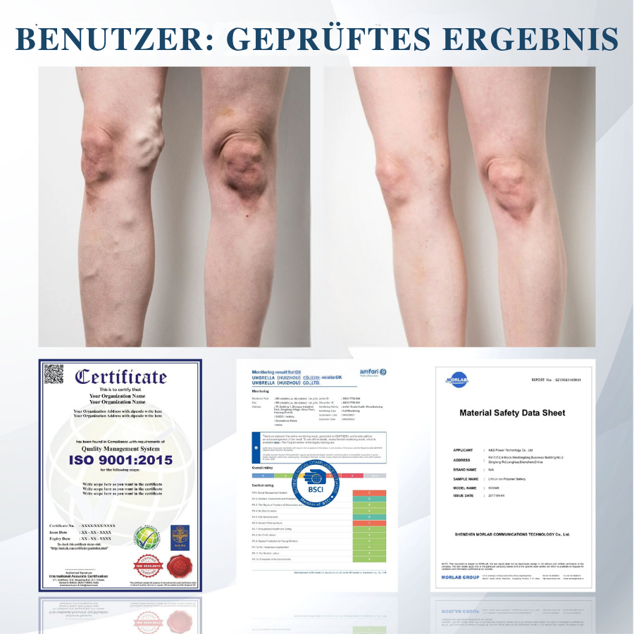 Fivfivgo® Schwarzkümmel Ödeme lindernde Kräutercreme