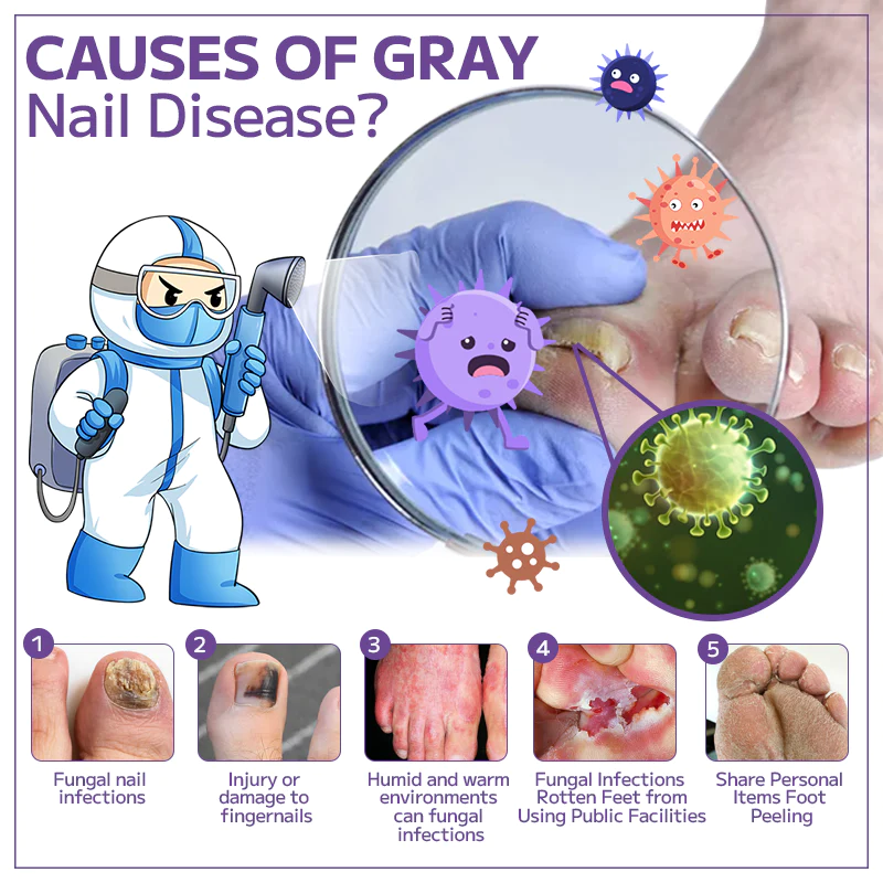 Fivfivgo™ Anti-fungal Nail Spray