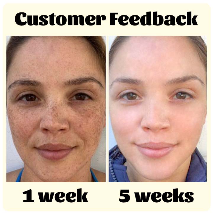 Fivfivgo™ RadiantTouch Sérum correcteur de taches brunes