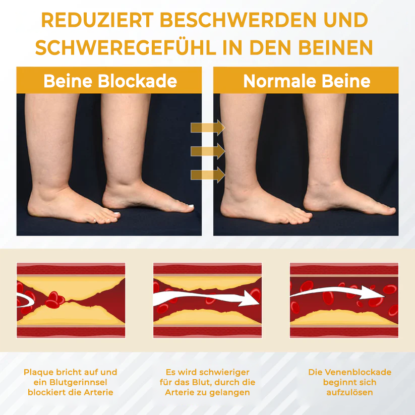 Fivfivgo® Bromelain Ödeme und Venen lindernde Creme