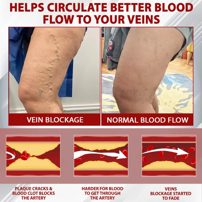 NovaRX® Red Vine FluidRelief Edema Gel