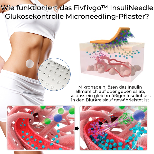 Fivfivgo™ InsuliNeedle Glukosekontrolle Microneedling-Pflaster