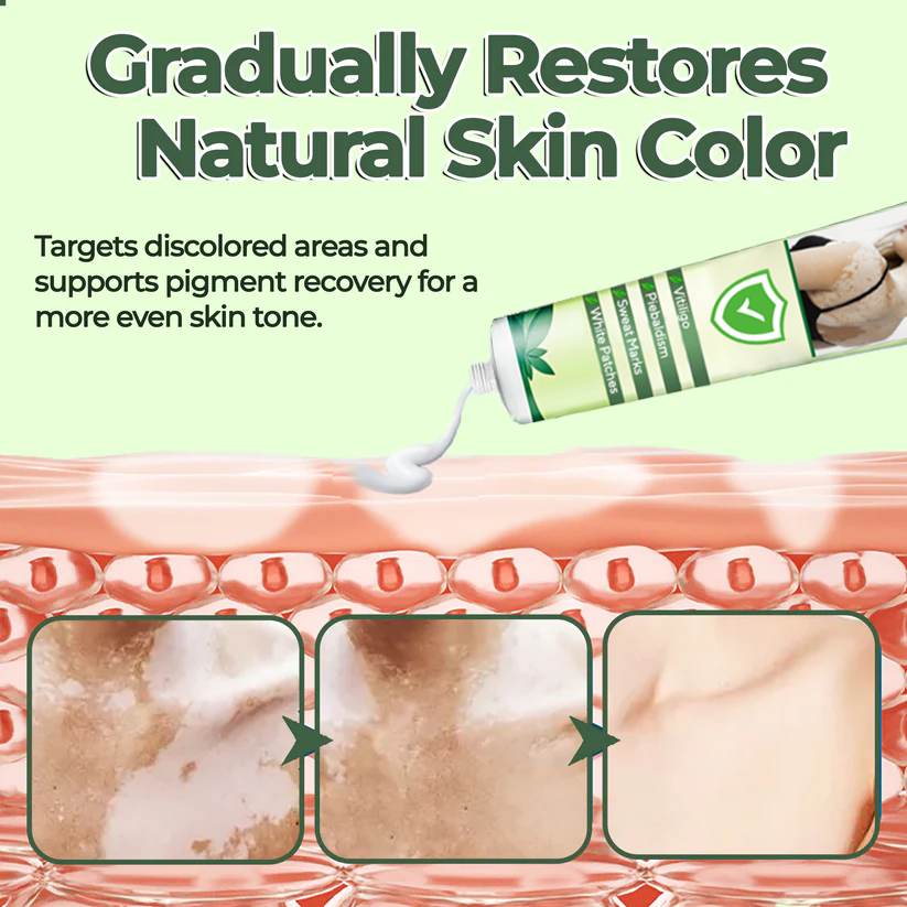 Fivfivgo® Vitiligo Treatment Ointment