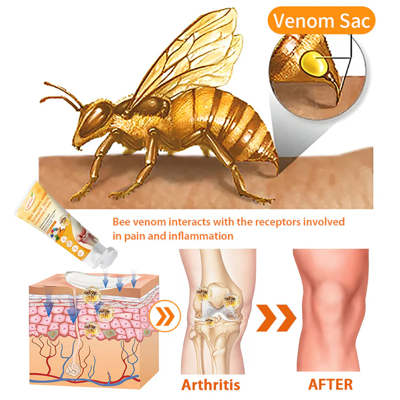 Fivfivgo™ Bee Venom and Turmeric Joint Treatment Cream (Specialized in relieving orthopedic discomfort and arthritis pain)
