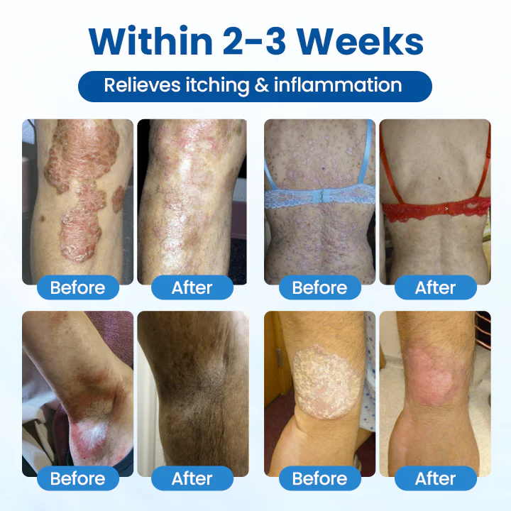 Fivfivgo® Magnesium Herbal Treatment Spray