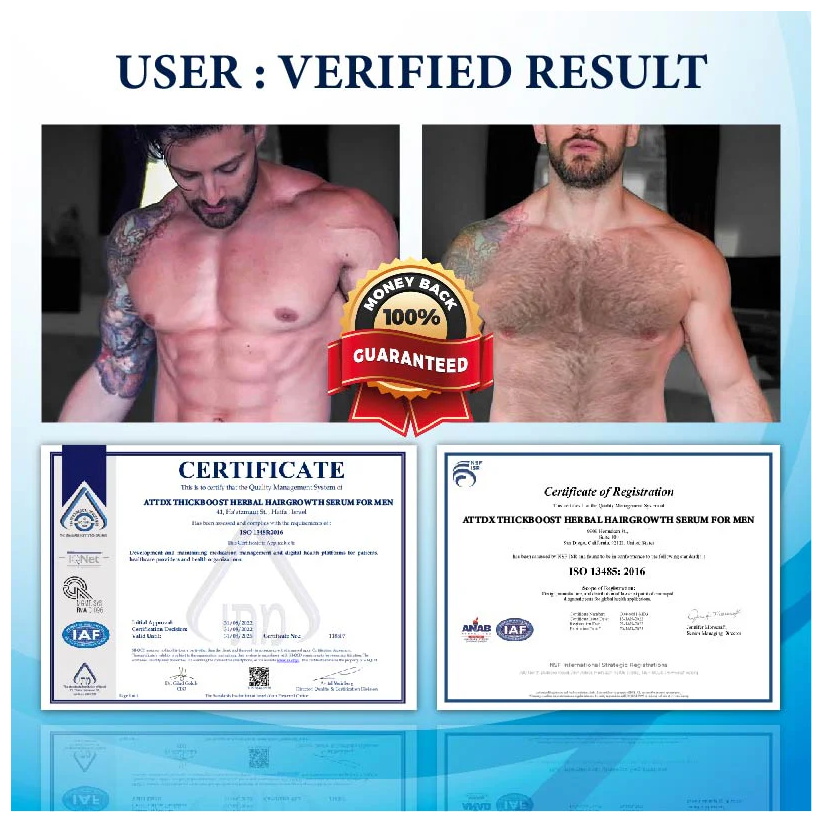 Fivfivgo™ ThickBoost Herbal HairGrowth Serum for Men