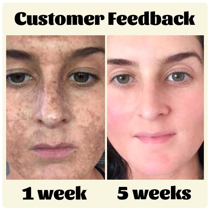 Fivfivgo™ RadiantTouch Serum zur Korrektur dunkler Flecken