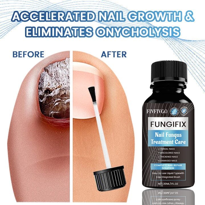 Fivfivgo™ FungiFix Nagelpilz-Behandlung Pflegeflüssigkeit
