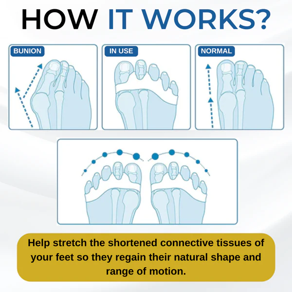 Fivfivgo™ Dr.Fit Silicone Bunion Corrector