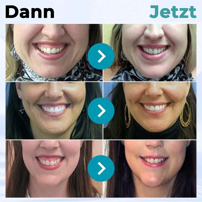 Fivfivgo® Zahnfleisch-Therapie Gel