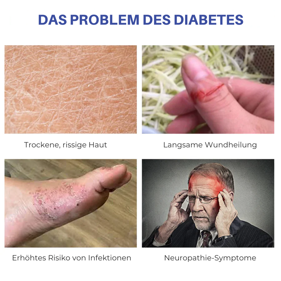 Cvreoz® DiaRelief Feuchtigkeitscreme (Spezialisiert für Diabetiker)