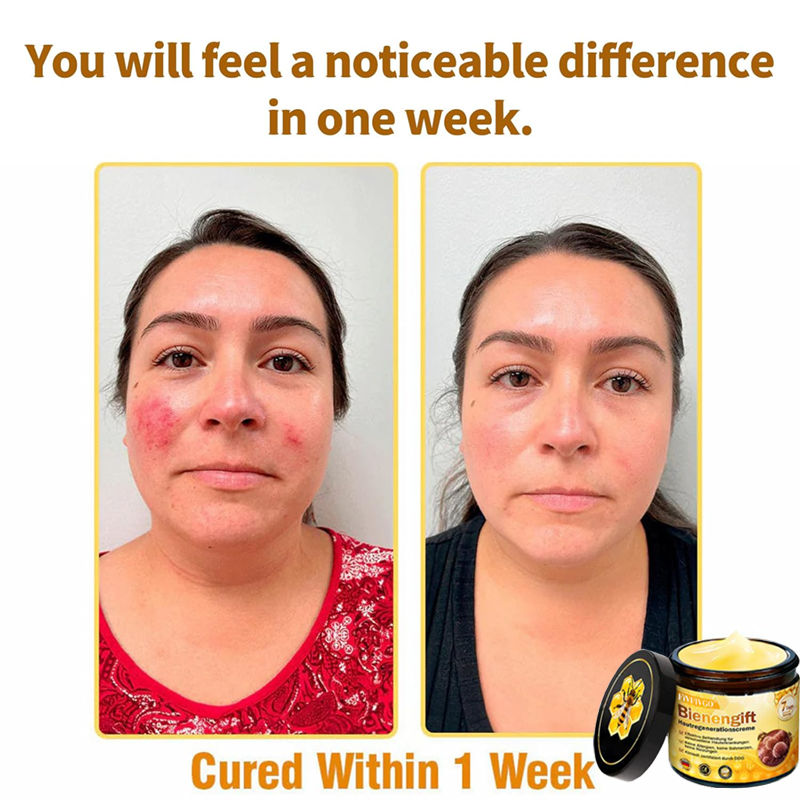 Fivfivgo™ Bee Venom Skin Regeneration Cream