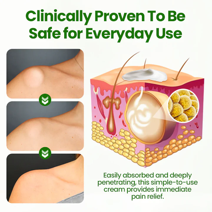 Fivfivgo® KnotAway Lipoma Removal Cream