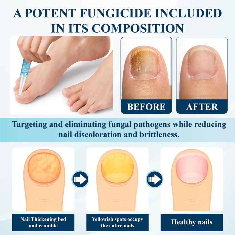 Fivfivgo® MycoStop Nail Recovery Serum Pen