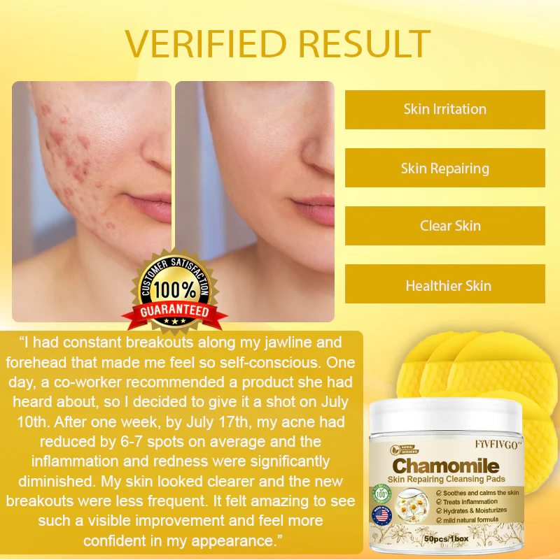 Fivfivgo™ Chamomile Skin Repairing Cleansing Pads