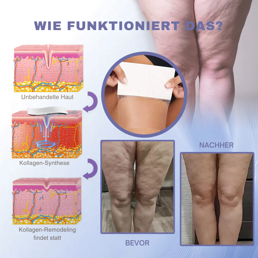 Fivfivgo® Schlankheitskur Unsichtbarer Beinlift