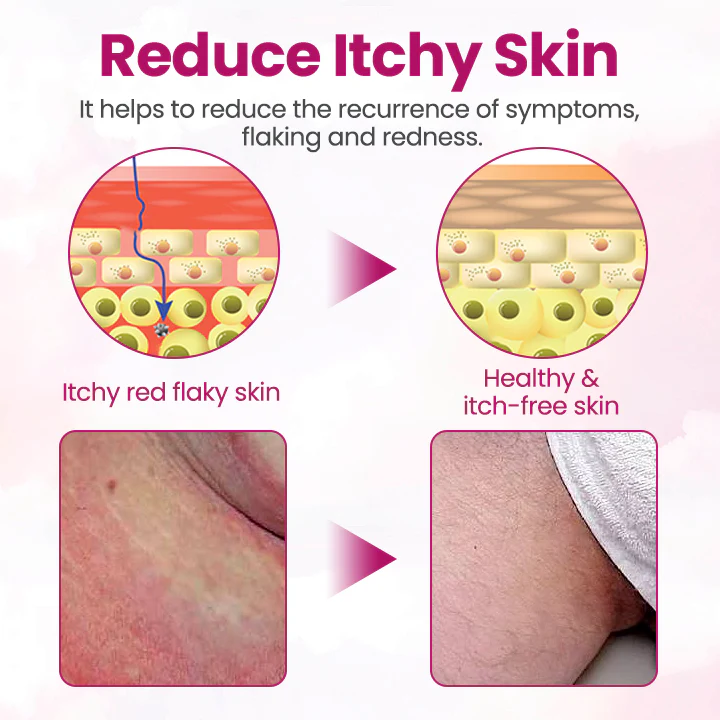 Fivfivgo® Women’s GentY Relief Cream