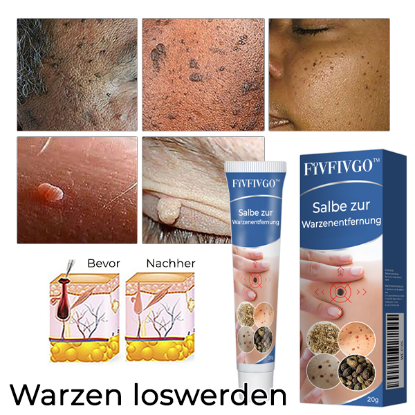 Fivfivgo™ Salbe zur Warzenentfernung
