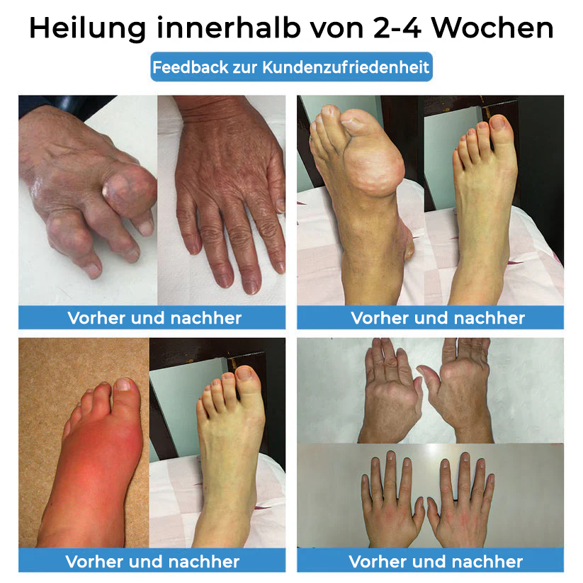 ✅ Offizieller Laden: Fivfivgo® Nano-Mikronadel-Gelenkpflaster