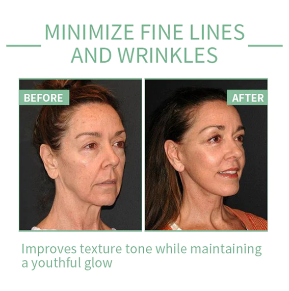 Sérum anti-âge Fivfivgo™ Collagen Boost pour éliminer 97 % des rides profondes et des taches brunes