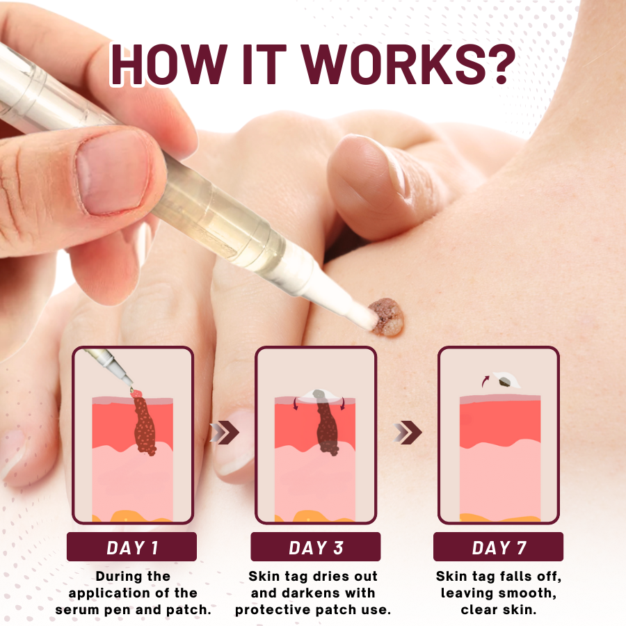 Fivfivgo™ Skin Tag Removal Stickers