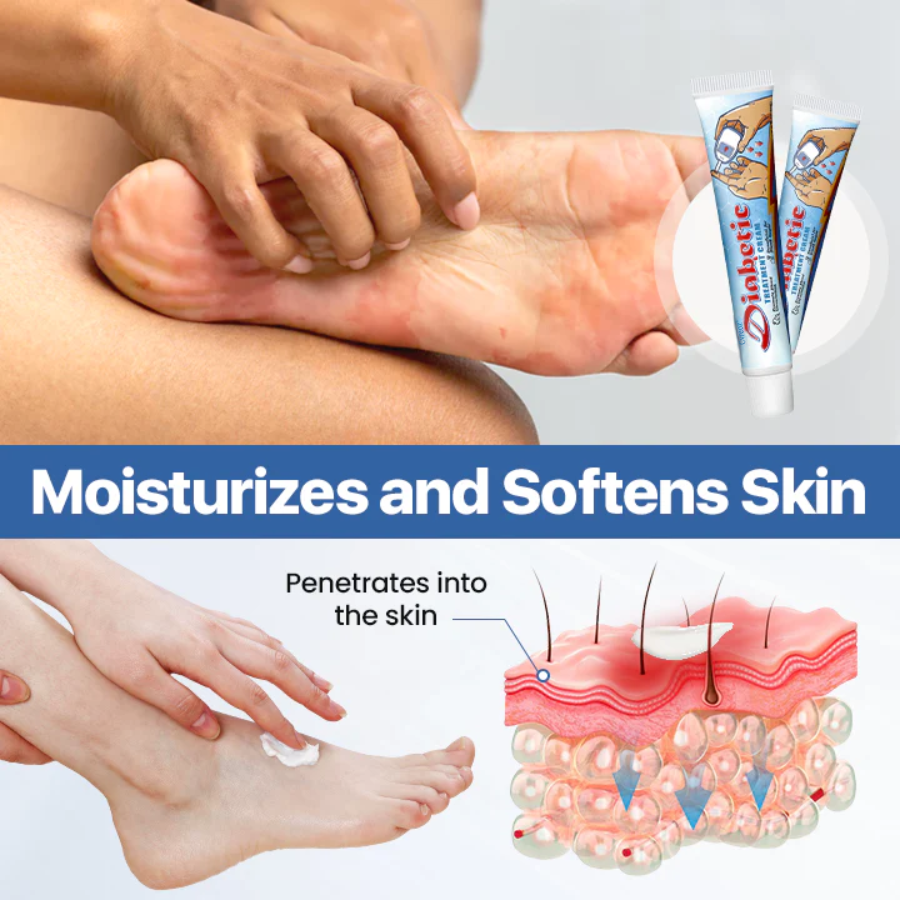 Cvreoz® VitaGluco Diabetes Treatment Cream