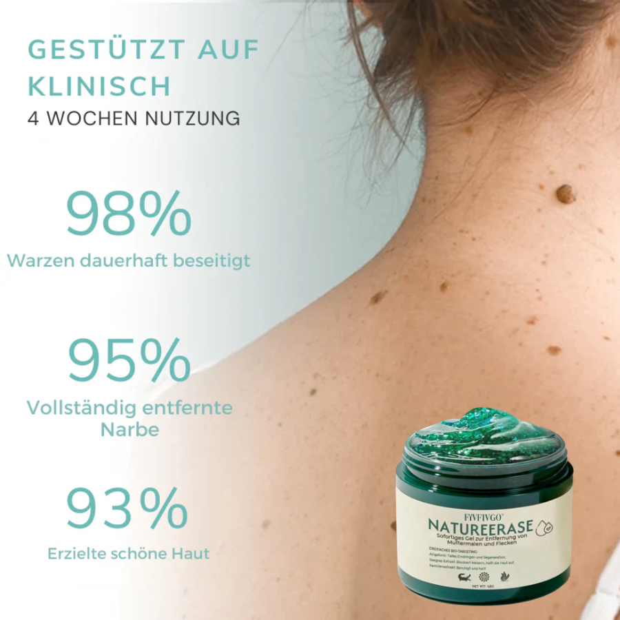 ✅ Offizieller Laden: Fivfivgo® NatureErase Sofortiges Gel zur Entfernung von Muttermalen und Flecken