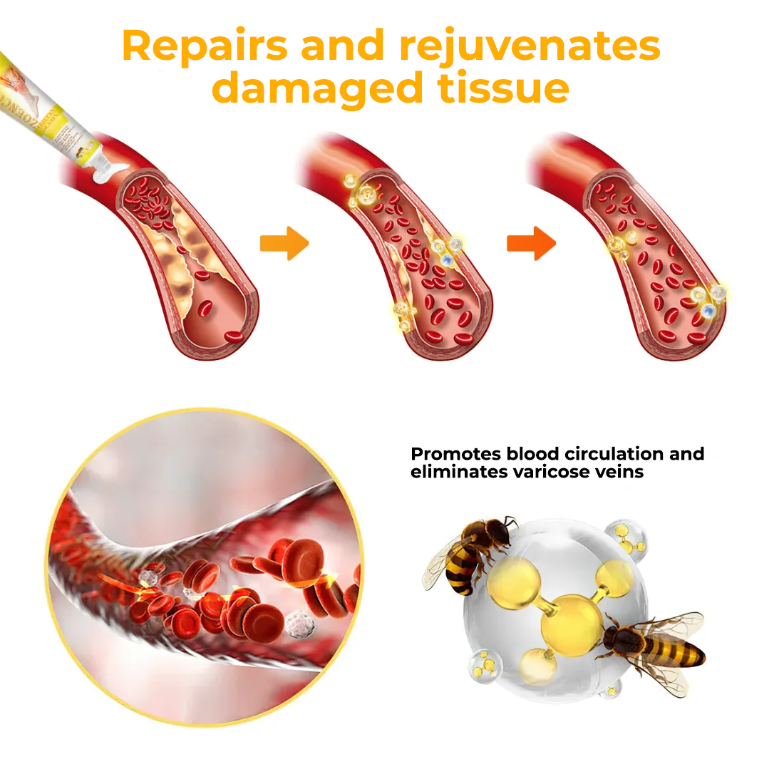 Fivfivgo™ Creme zur Behandlung von rheumatoider Arthritis und Krampfadern